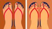 5 Reasons Doctors Are Now Warning People To Never Wear Flip Flops