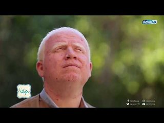حياتنا - أحمد أسعد عدو الشمس.. مؤسس أول صفحة ألبينو في مصر يسرد معاناته في مصر بسبب لون بشرته