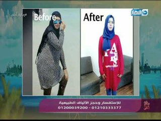 وبكرة أحلى - لقاء مع  د. أحمد عبدلله أستشاري علاج السمنة