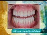 اسأل مع دعاء - ا.د / شادي علي حسين مدرس بكلية طب أسنان جامعة عين شمس