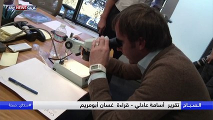 احذر العدسات اللاصقة.. تسبب العمى