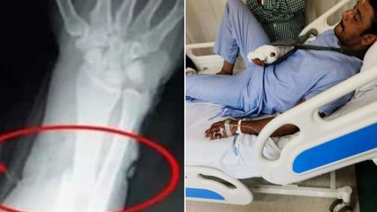 ಹೇಗಿದೆ ನೋಡಿ ಆಸ್ಪತ್ರೆಯಲ್ಲಿ ದರ್ಶನ್ ಪರಿಸ್ಥಿತಿ..!  | Filmibeat Kannada