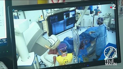 Médecine : une opération du cœur sous hypnose