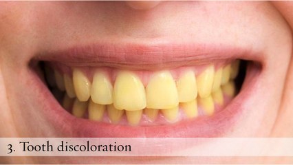 Root Canal Procedures and Guidelines