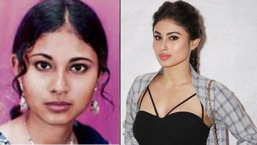 Mouni Roy looks Unrecognizable; Is Cosmetic Surgery went WRONG? find