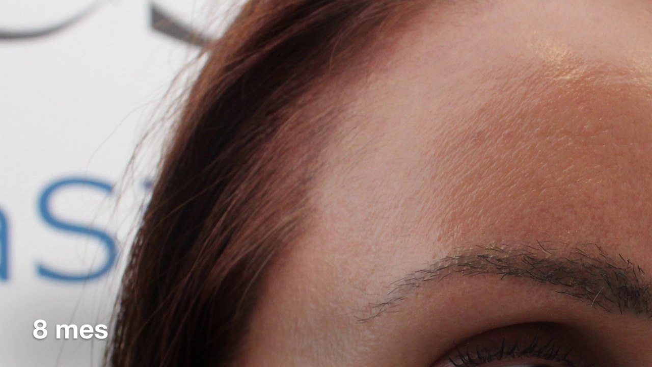 ClinicaSigma Madrid, Dr.Alex Seiadatan, www.seiadatan.com