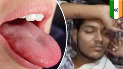 Husband gets tongue bitten off by pregnant wife for being ugly
