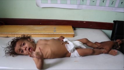 الحكومة اليمنية ترفض التمديد لفريق الخبراء الأممي