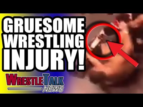 WWE Star Accused Of Bullying?! GRUESOME Wrestling Injury! | WrestleTalk News Sept. 2018
