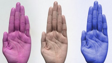 இந்த ஆறில் உங்க உள்ளங்கை எந்த கலர்னு சொல்லுங்க- வீடியோ