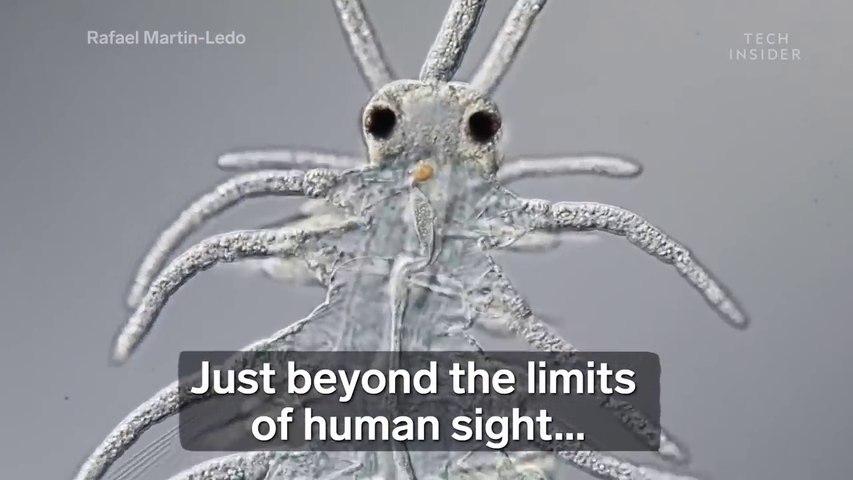 Award-Winning Footage Of The Microsopic World Around Us