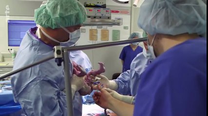 La césarienne  une pratique controversée  Documentaire complet  ARTE