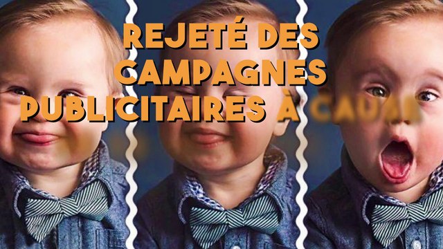 Rejeté des campagnes publicitaires à cause de son handicap, ce petit garçon devient une star sur internet