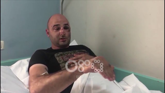 Ora News - Tiranë, Policia ndjek dhe plagos 28 vjeçarin. Ishte goditje e pavullnetshme