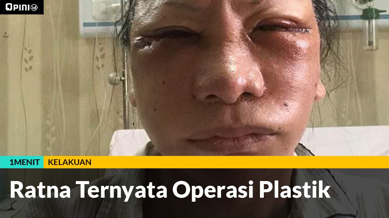 #1MENIT | Ratna Ternyata Operasi Plastik