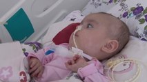 Sma Hastası 8 Aylık Hafsa Nur Yardım Bekliyor