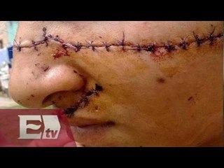 Cortan su rostro  por ser bonita / Global Paola Barquet