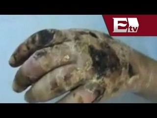 PAN pide cerco de seguridad para evitar la llegada de Krokodil a México / Enrique Sánchez