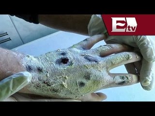Krokodil: PGR y PF vigilancia fronteras del país / Excélsior Informa