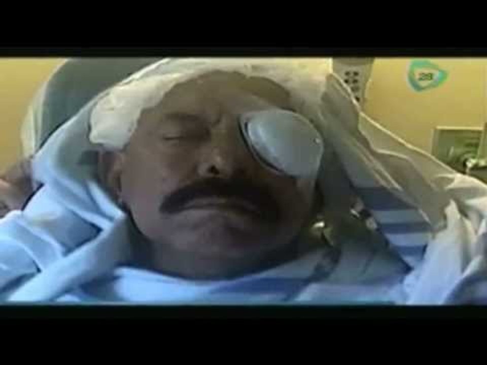 Oscar D'León podría perder un ojo /cantante de salsa venezolano Oscar D'León sufre accidente