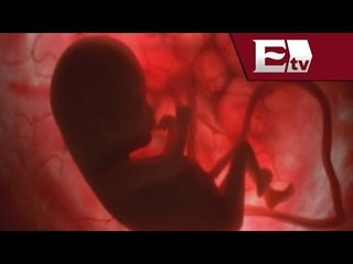 ¿Qué riesgos implica un aborto clandestino? / Salud con Gloria Contreras