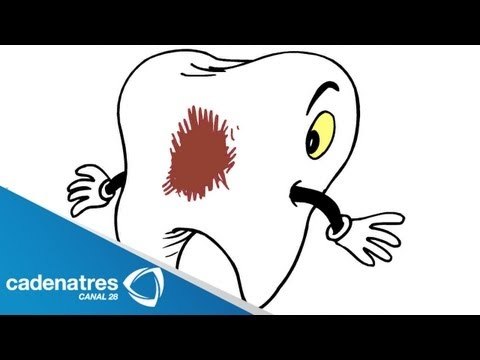 Conceptos básicos sobre las caries / Como prevenir la caries en los dientes de los niños