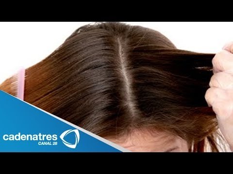 ¿Peligro al usar pesticidas para eliminar piojos?