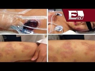 Mejora la salud de Owen niño que sufrió violencia familiar / Titulares de la noche