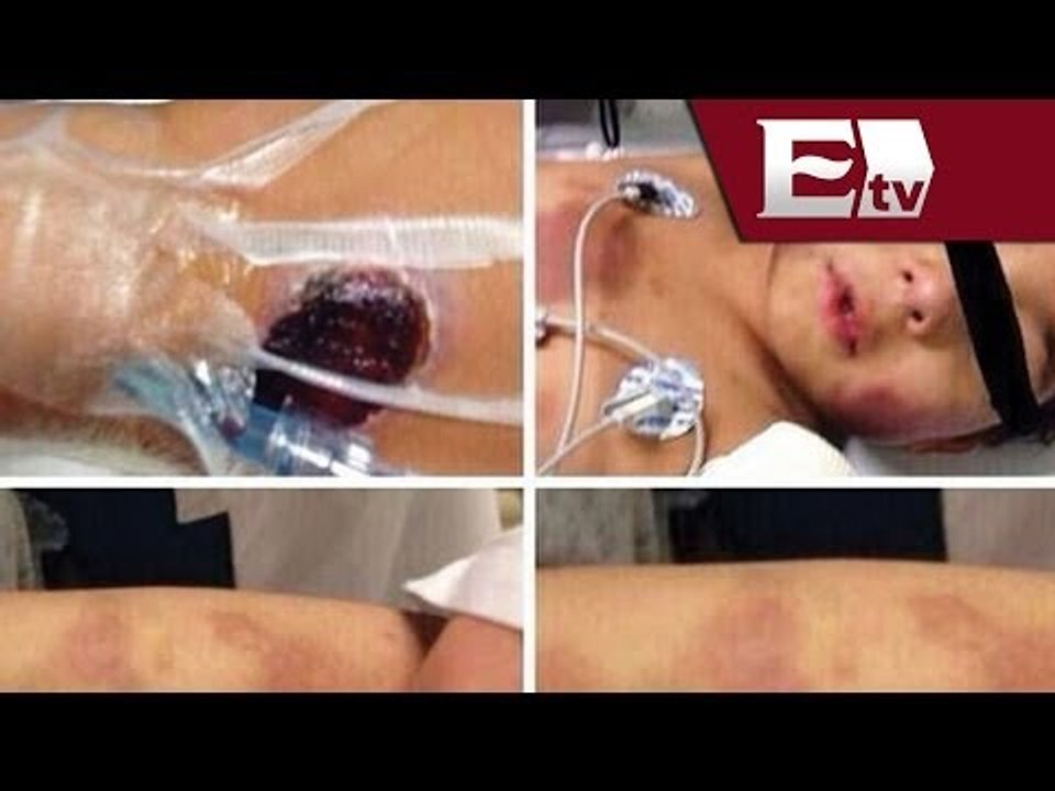 Detienen a la madre de Owen, niño brutalmente golpeado en el Estado de México / #RescatemosAOwen