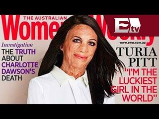 Mujer sobreviviente de incendio en portada de revista de moda / Andrea Newman