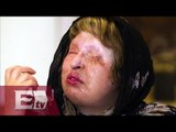 Irán castigará con la horca los ataques con ácido a mujeres/ Entre Mujeres