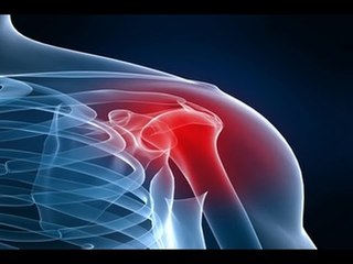 ¿Cómo curar lesiones musculares y en articulaciones? / Nuestro Día