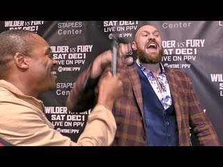 TYSON FURY: Deontay Wilder WILL QUIT! Mentally WEAK!!
