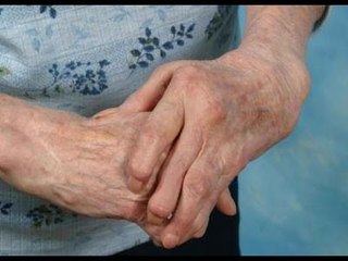 ¿Qué es la artritis reumatoide?