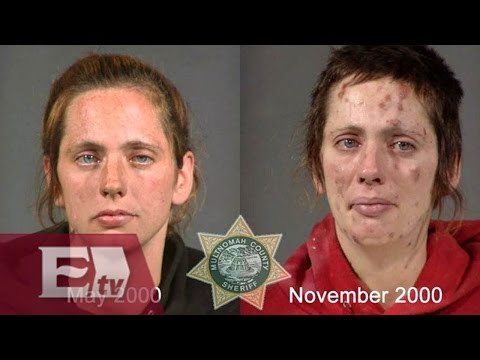 EntLos cambios físicos por culpa del consumo de drogas/ Entre Mujeres