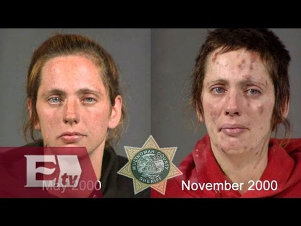 EntLos cambios físicos por culpa del consumo de drogas/ Entre Mujeres