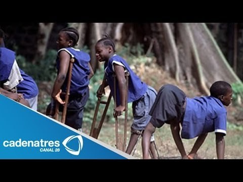 Alerta médica en Estados Unidos por casos de parálisis en niños con poliomielitis