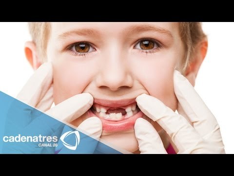 ¿Qué hacer ante un traumatismo dental en niños?