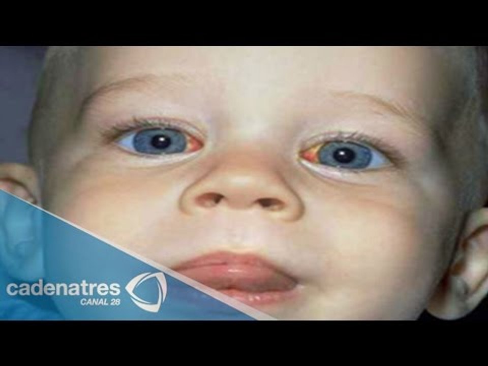 Cirugías en niños, ¿cuáles sí y cuáles no?