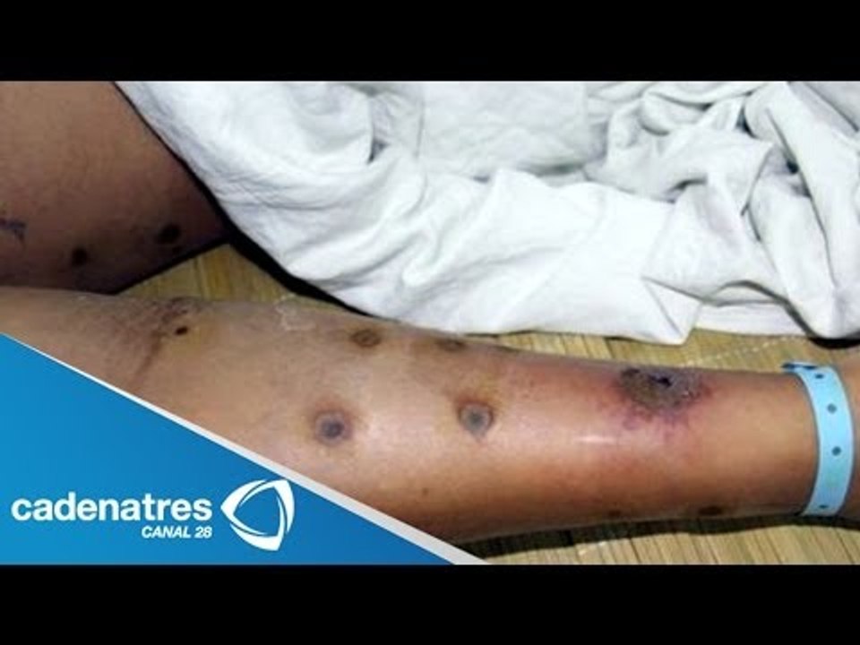 Enjambre de abejas ataca a familia en San Luis Potosí / Swarm of bees attacks family SLP