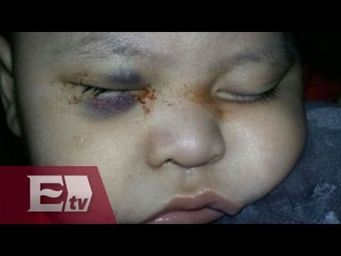 Médico que extirpó un ojo a bebé rinde declaraciones en la PGR / Titulares de la tarde