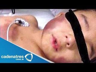 Niño de 5 años llega a hospital con quemaduras en los genitales en Tlalnepantla