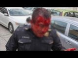 ¡FUERTES IMÁGENES! Enfrentamiento en San Bartolo dejan 50 policías lesionados