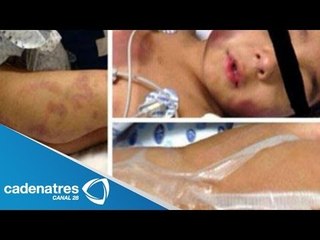 Owen, el niño golpeado por su padrastro aún no tiene un hogar