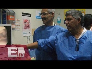 Doctores mexicanos retiran tumor considerado como inoperable / Vianey Esquinca