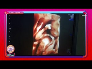 El aborto no es un método anticonceptivo | Sale el Sol