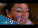 Mujer con lesiones en el rostro tras tener contacto con río contaminado en Sonora