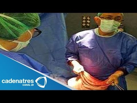 Extirpan a mujer tumor de más de 60 kilos / Tumor removed woman over 60 kilos