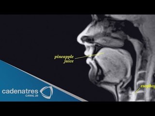 ¿Cómo responde el cuerpo ante un beso? / Experimento de resonancia magnética