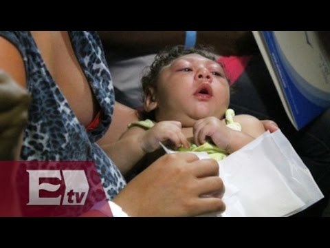 Posible vínculo entre virus del Zika y la microcefalia: OMS / Francisco Zea